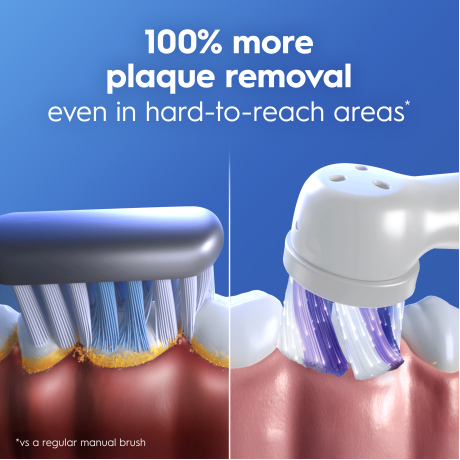  أورال-بي فرشاة أسنان كهربائية iO Series 2 لون أسود 